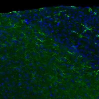 Immunohistochemistry: TLR4 Antibody (76B357.1) - Azide Free [NBP2-27149]