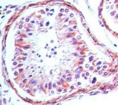 Immunohistochemistry-Paraffin: TLR4 Antibody (76B357.1) - Azide Free [NBP2-27149]