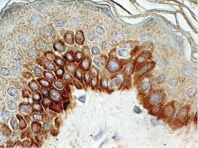 Immunohistochemistry-Paraffin: TLR4 Antibody (76B357.1) - Azide Free [NBP2-27149]