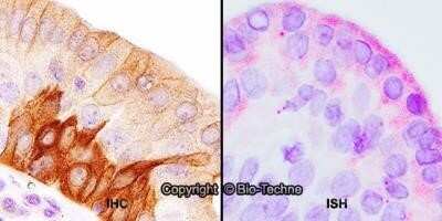 Immunohistochemistry-Paraffin: TLR4 Antibody (76B357.1) - Azide Free [NBP2-27149]