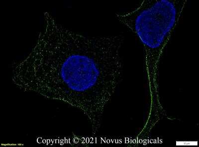 Immunocytochemistry/ Immunofluorescence: TLR4 Antibody (76B357.1) - BSA Free [NB100-56566]