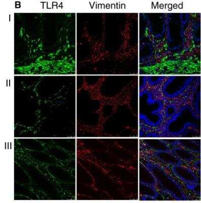 Immunohistochemistry: TLR4 Antibody (76B357.1) - BSA Free [NB100-56566]