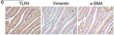 Immunohistochemistry: TLR4 Antibody (76B357.1) - BSA Free [NB100-56566]