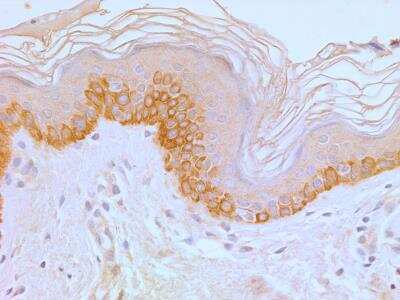 Immunohistochemistry-Paraffin: TLR4 Antibody (76B357.1) - BSA Free [NB100-56566]