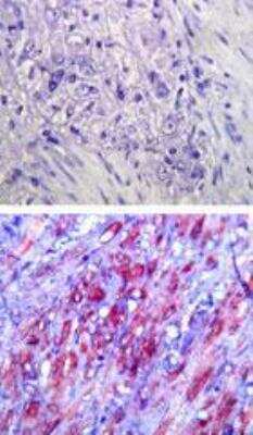 Immunohistochemistry-Paraffin: TLR4 Antibody (76B357.1) - BSA Free [NB100-56566]
