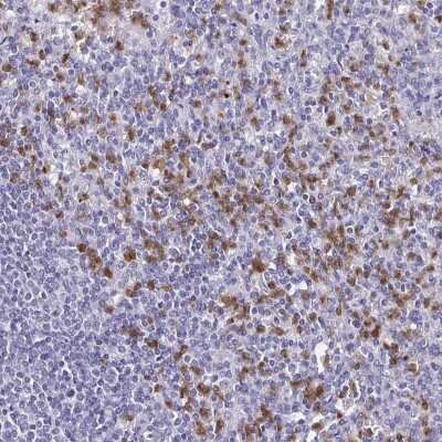 Immunohistochemistry: TLR4 Antibody [NBP2-47604]