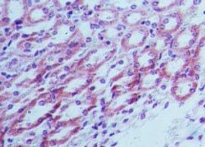 Immunohistochemistry-Paraffin: TLR4 Antibody [NB100-56580]