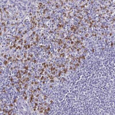 Immunohistochemistry-Paraffin: TLR4 Antibody [NBP2-47604]