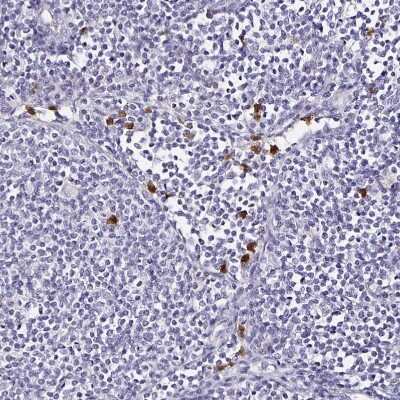 Immunohistochemistry-Paraffin: TLR4 Antibody [NBP2-47604]