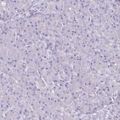 Immunohistochemistry-Paraffin: TLR4 Antibody [NBP2-47604]