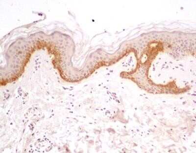 Immunocytochemistry: TLR5 Antibody (19D759.2) - Azide and BSA Free [NBP2-80981]