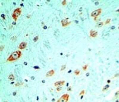 Immunohistochemistry: TLR5 Antibody (19D759.2) - Azide and BSA Free [NBP2-80981]