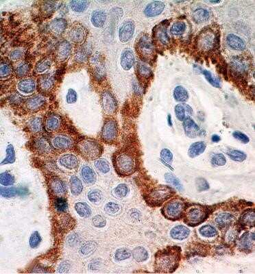Immunohistochemistry-Paraffin: TLR5 Antibody (19D759.2) - Azide and BSA Free [NBP2-80981]