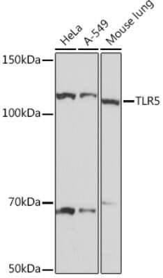 Western Blot: TLR5 Antibody (6P1Q10) [NBP3-16698]