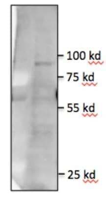 Western Blot: TLR5 Antibody (85B152.5)Azide Free [NBP2-33253]