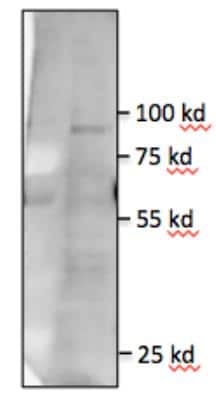 Western Blot: TLR5 Antibody (85B152.5)BSA Free [NBP1-97728]