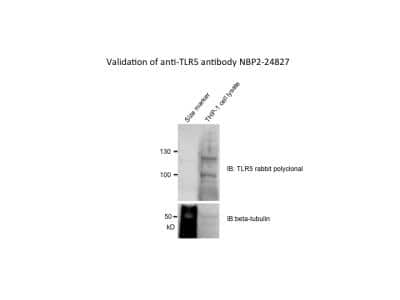 Western Blot: TLR5 Antibody [NBP2-24827]