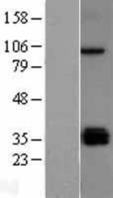 Western Blot: TLR5 Overexpression Lysate [NBL1-16954]