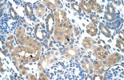 Immunohistochemistry-Paraffin: TLR6 Antibody [NBP1-54336]