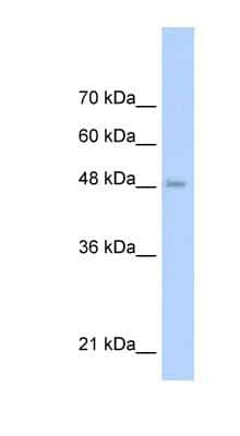 Western Blot: TLR6 Antibody [NBP1-54336]