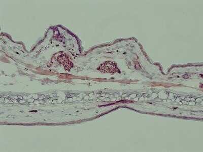 Immunohistochemistry-Frozen: TLR7 Antibody - Azide Free [NBP2-24905]