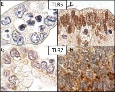 Immunohistochemistry: TLR7 Antibody - Azide Free [NBP2-24905]