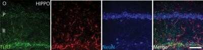 Immunohistochemistry: TLR7 Antibody - Azide Free [NBP2-24905]