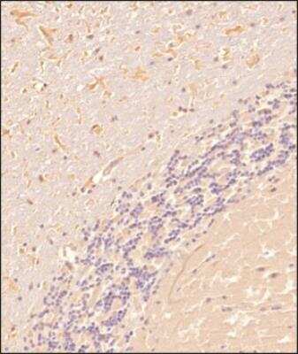 Immunohistochemistry: TLR7 Antibody (4G6) - BSA Free [NBP2-27332]