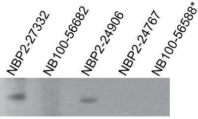 Western Blot: TLR7 Antibody (4G6)BSA Free [NBP2-27332]