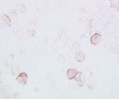 Immunohistochemistry: TLR7 Antibody (66H3) [DDX0500P-100]