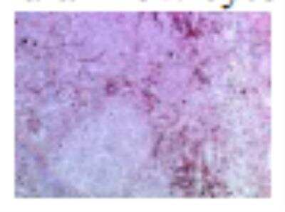 Immunohistochemistry: TLR7 Antibody (66H3) [DDX0500P-100]