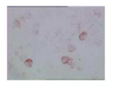 Immunohistochemistry: TLR7 Antibody (66H3) [DDX0500P-100]