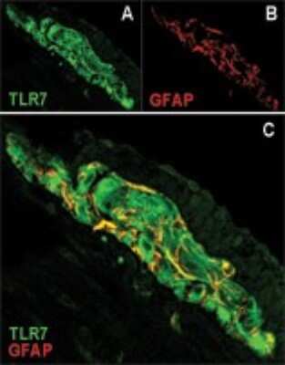 Immunocytochemistry/ Immunofluorescence: TLR7 Antibody - BSA Free [NBP2-24906]