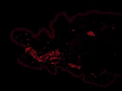 Immunohistochemistry-Frozen: TLR7 Antibody - BSA Free [NBP2-24906]