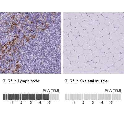 Immunohistochemistry-Paraffin: TLR7 Antibody [NBP2-32483]