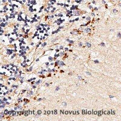 Immunohistochemistry: TLR7 Antibody Pack [NBP2-31097]