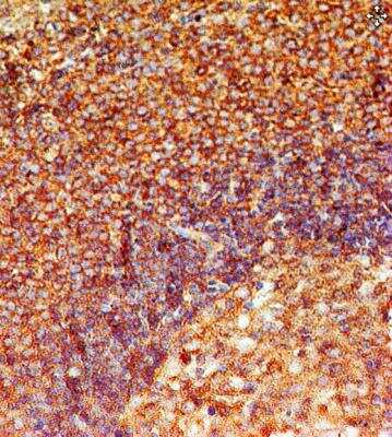 Immunohistochemistry-Paraffin: TLR8 Antibody (44C143) - BSA Free [NBP2-24917]