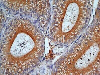 Immunohistochemistry: TLR9 Antibody (2A4C6.2E5) - Azide and BSA Free [NBP2-80983]