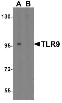 Western Blot: TLR9 AntibodyBSA Free [NBP1-76680]