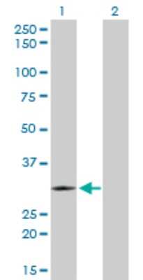 Western Blot: TLX3 Antibody (2A3) [H00030012-M01]