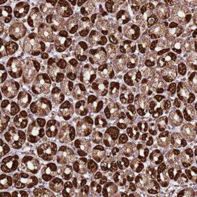 Immunohistochemistry: TM2D2 Antibody [NBP2-30917]