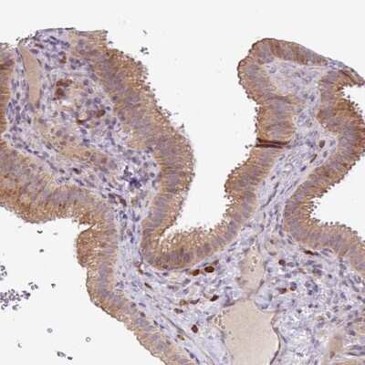 Immunohistochemistry-Paraffin: TM2D2 Antibody [NBP2-30462]