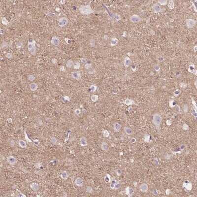 Immunohistochemistry-Paraffin: TM6SF2 Antibody [NBP2-49469]