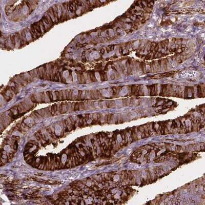 Immunohistochemistry-Paraffin: TM6SF2 Antibody [NBP2-49469]