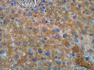 Immunohistochemistry-Paraffin: TM6SF2 Antibody [NBP3-12197]