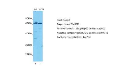 Western Blot: TM6SF2 Antibody [NBP2-85928]
