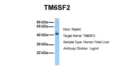 Western Blot: TM6SF2 Antibody [NBP2-85928]