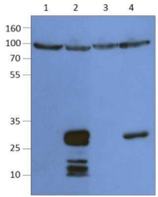 Western Blot: TM6SF2 Antibody [NBP3-12197]
