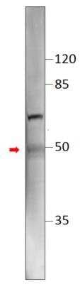 Western Blot: TM6SF2 Antibody [NBP3-12197]