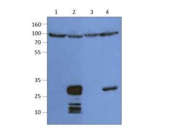 Western Blot: TM6SF2 Antibody [NBP3-12202]